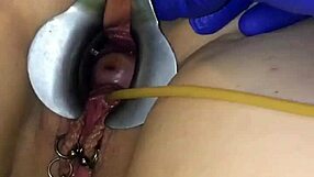 Female receives intriguing anal injections.