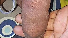 myanmar gay cocklovermlm experiments with homemade saline injection