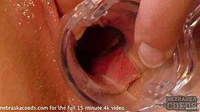 Young blonde's gyno exam and peeing closeups in hospital