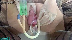 asian wife demonstrates extreme cervix stretching with bottles in homemade video