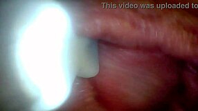 Educational penis endoscope video