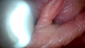 Educational penis endoscope video