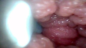 Educational penis endoscope video