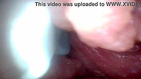 Educational penis endoscope video