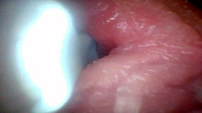 Endoscope Camera Reveals Sensitive Penis Parts in Detailed Educational Video