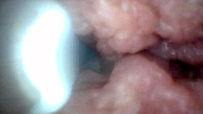 Educational penis endoscope video