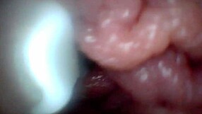 Educational penis endoscope video