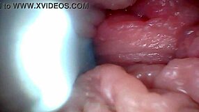 Educational penis endoscope video