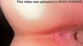 Girl Worries About Pigmented Anal Cleanliness