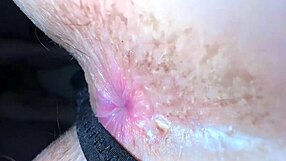 Girl Worries About Pigmented Anal Cleanliness