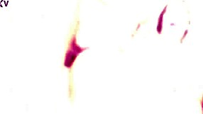 Alexxa Vice Goes Wild with Balls Deep Anal Dap Gapes Small 18+ Buttrose and Swallow