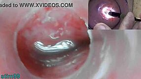 Mature milf explores cervix with endoscope camera