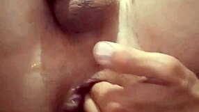 Anal fisting left my sphincter permanently open